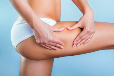 inestetismi cellulite